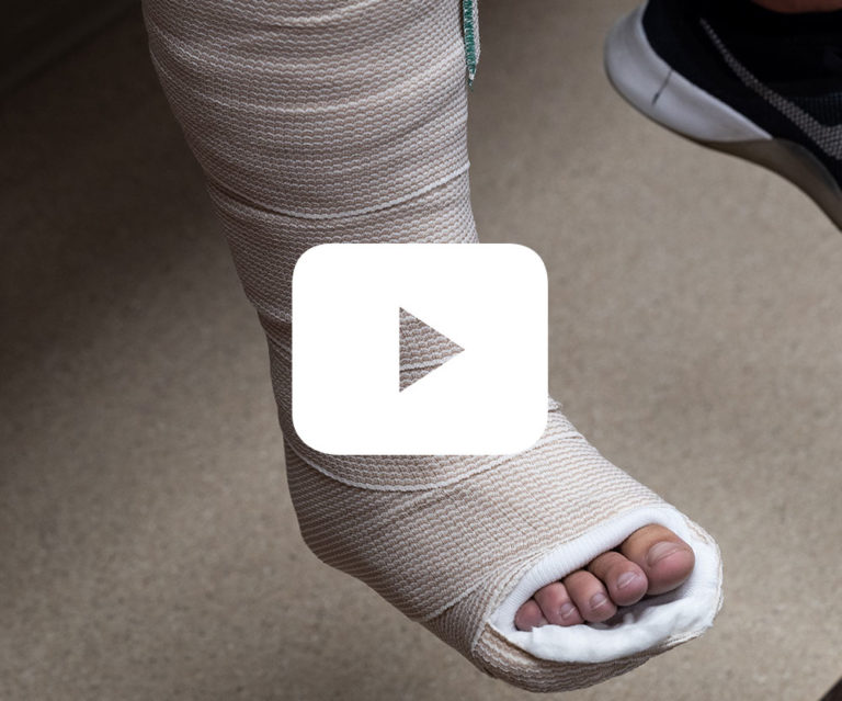 Physician Splinting Guide Proliance Orthopaedics & Sports Medicine